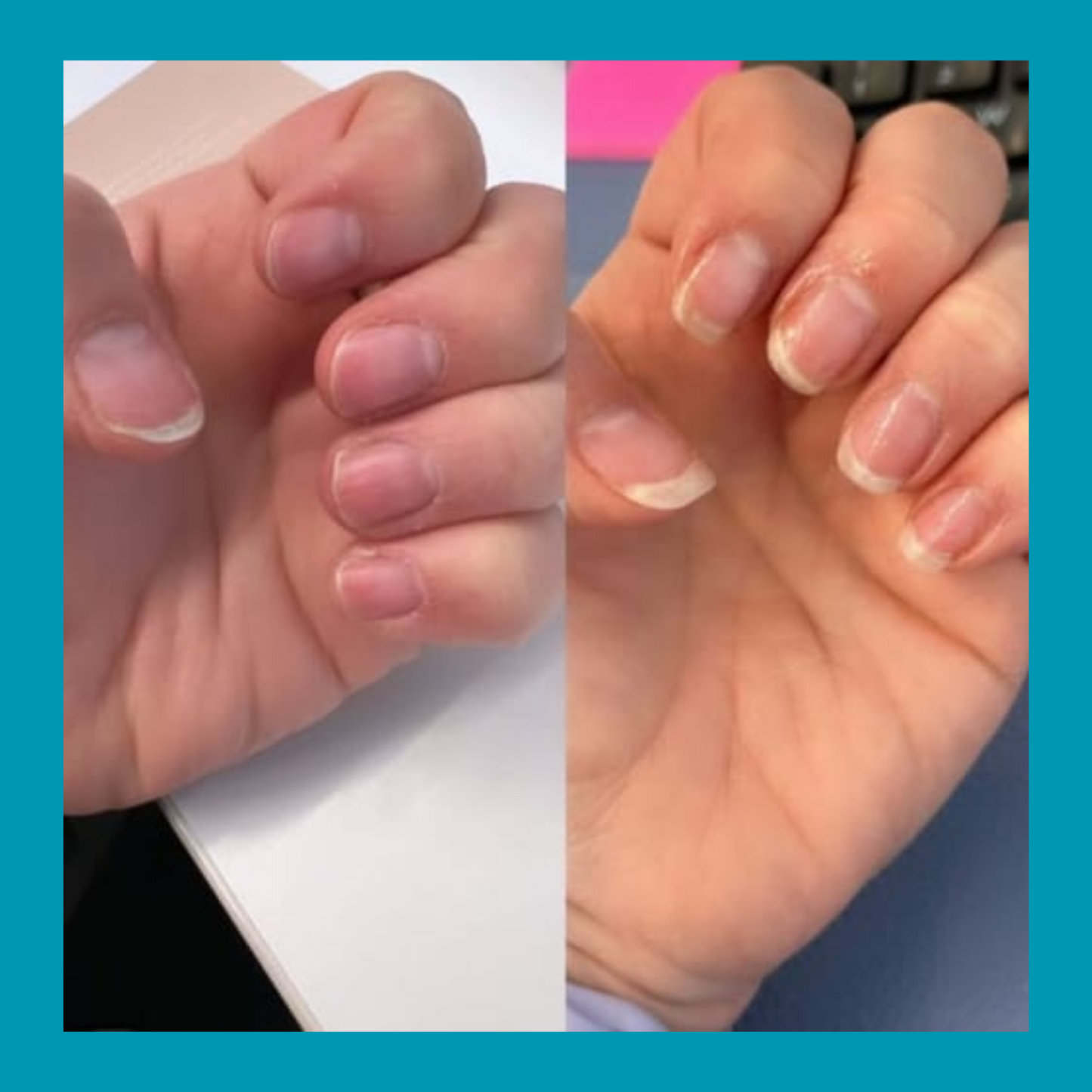 NAIL GROWTH OIL